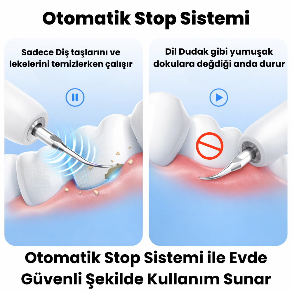 Ultrasonik Diş Temizleyici | Evde Kolay ve Güvenli Diş Taşı ve Leke Temizliği