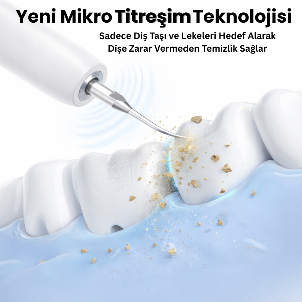 Ultrasonik Diş Temizleyici |  Evde Kolay ve Güvenli Diş Taşı ve Leke Temizliği